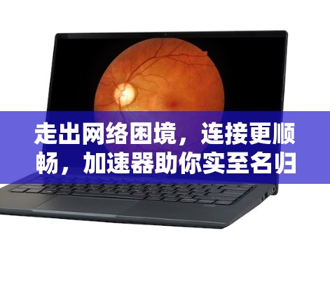 走出网络困境，连接更顺畅，加速器助你实至名归